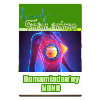 Homamiadan'ny Nono
