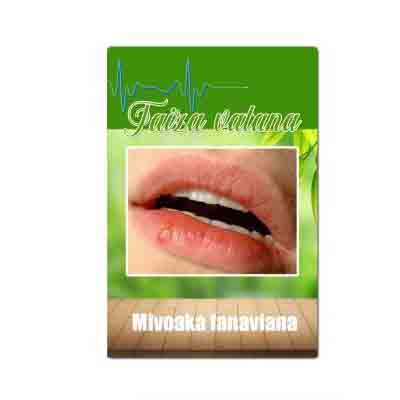 Mivoaka fanaviana