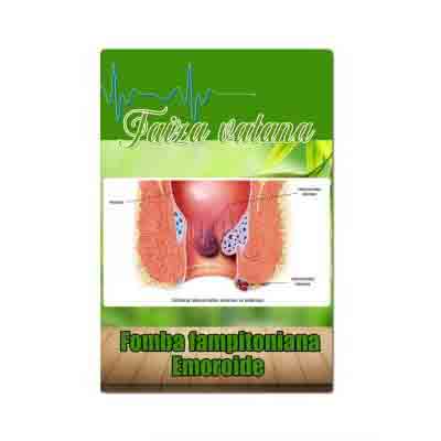 Fomba fampitoniana Hemoroide